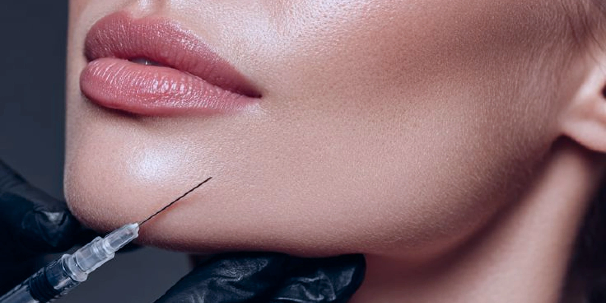 Ботулинотерапия