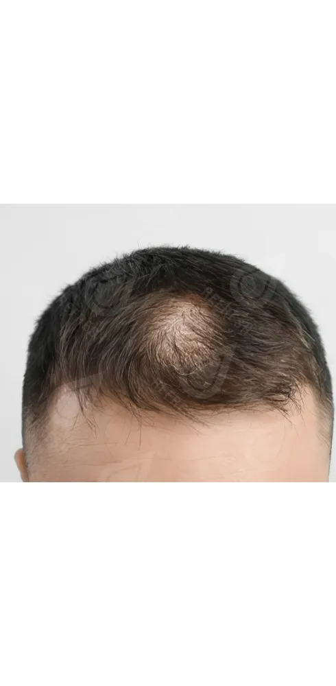 Восстановление волос 2