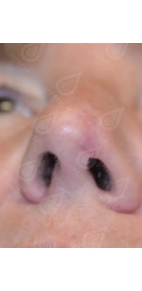 Реген.кожи5