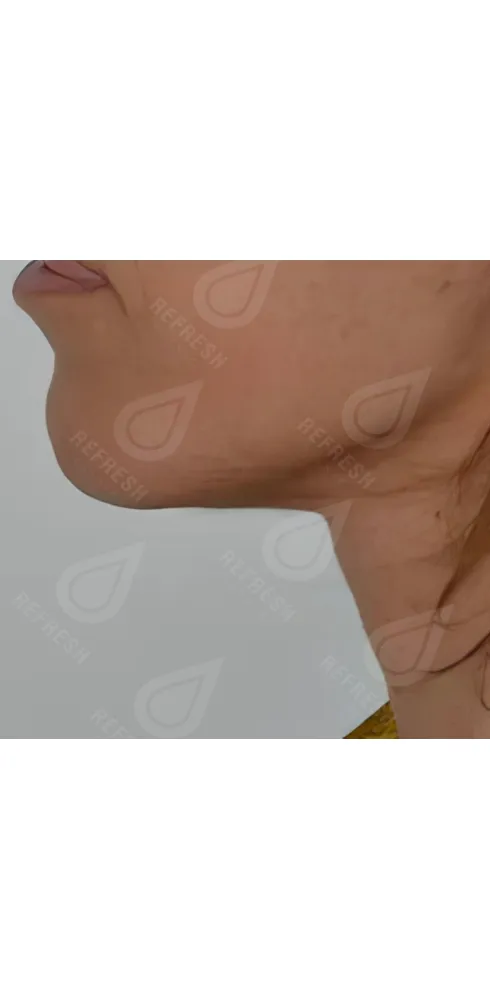 регенерация кожи 1