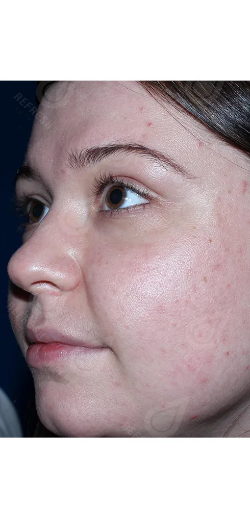 Реген.кожи2