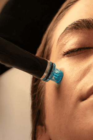  GLOW SHOT — IV Therapy + Hydrafacial