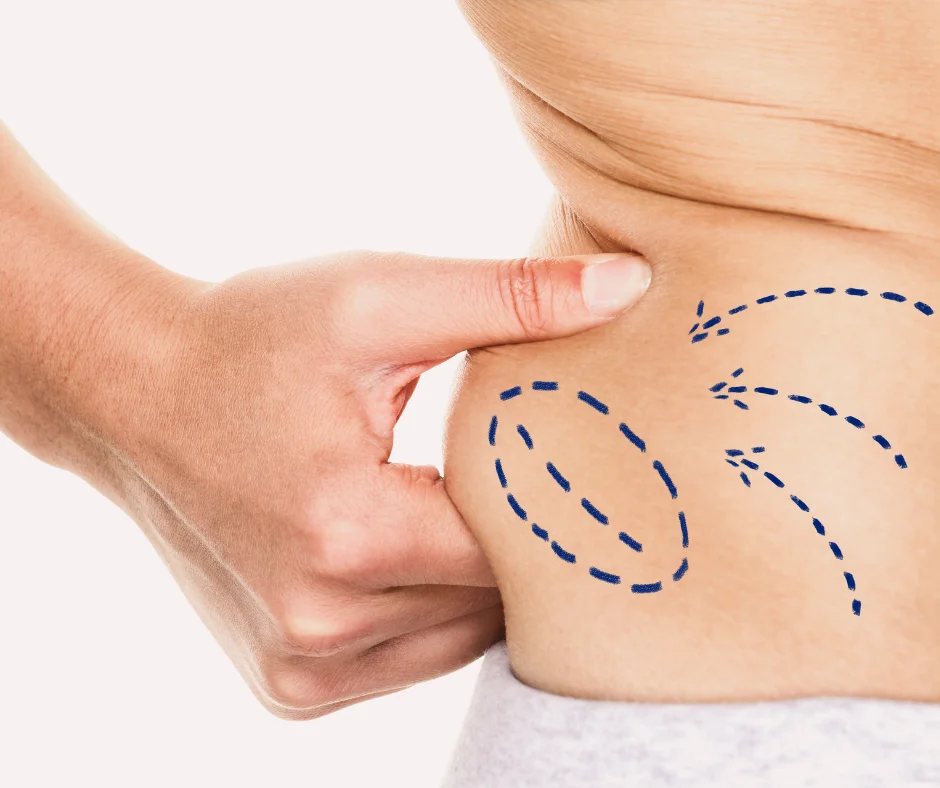 AOD-9604: пептид для снижения веса и улучшения состава тела