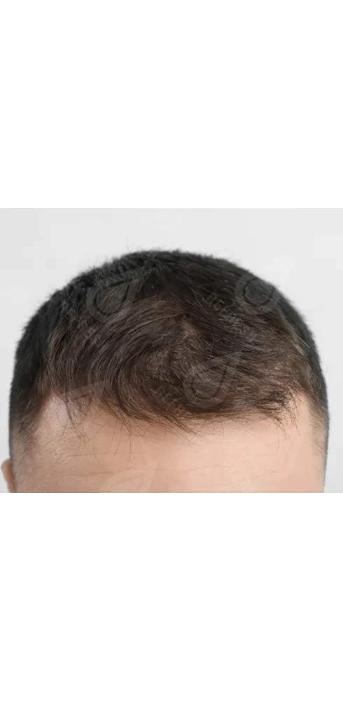 Восстановление волос 2