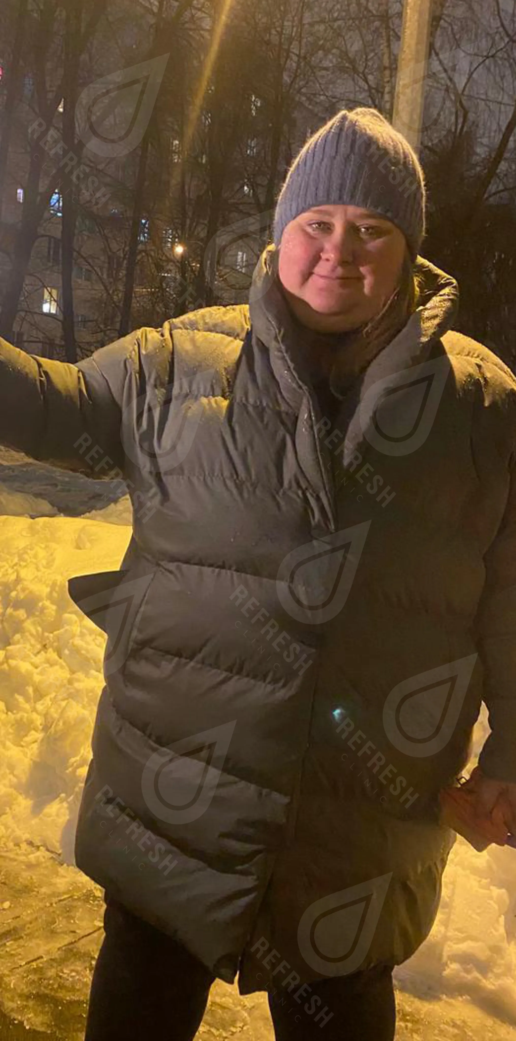 Похудение 3 