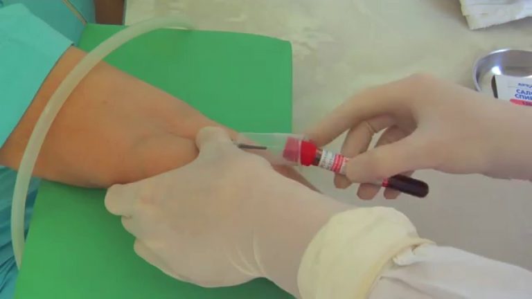 Что нельзя делать после сдачи крови из вены на анализы