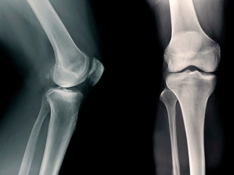 AOD-9604 и остеоартроз: что показывают современные экспериментальные исследования