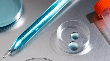 Чек-ап «Тест функции почек» 