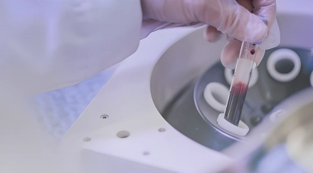 PRP-терапия (плазмотерапия)