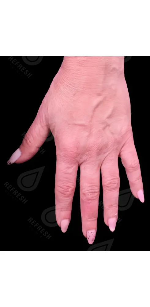 регенерация кожи 3