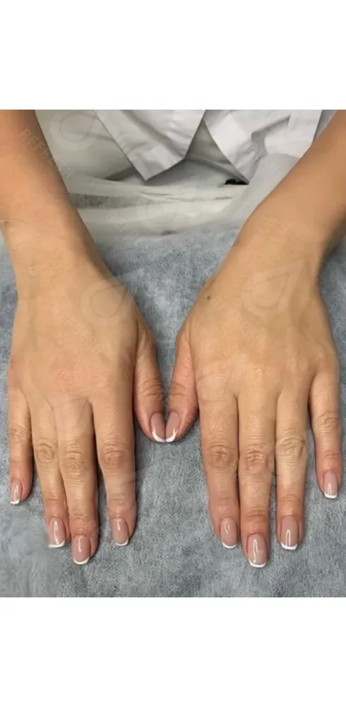 регенерация кожи 4