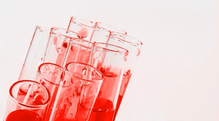 Чек-ап «Липидный профиль»